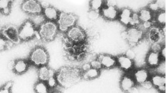 LACVirus216.9.jpg